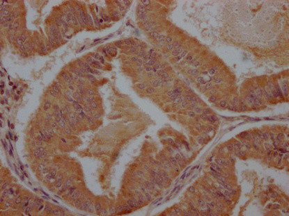 Anti-PCDHB7
