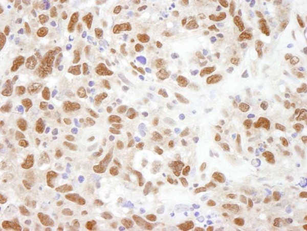 Anti-Bub3 (IHC)