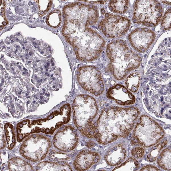 Anti-ATP5J2