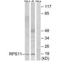 Anti-RPS11