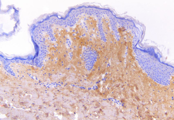 Anti-Collagen I, clone 15A11-3B9