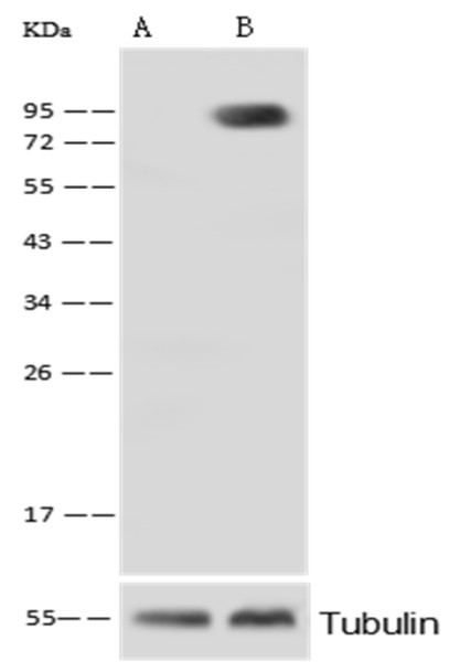 Anti-Alkaline Phosphatase/ALPL Monoclonal Recombinant Antibody
