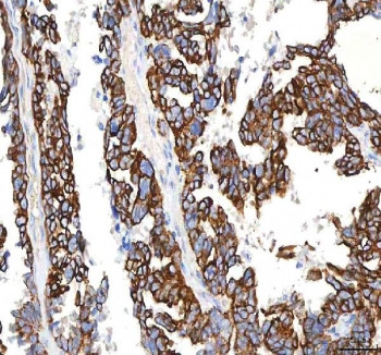Anti-PKDCC / SGK493 / Protein kinase domain-containing protein, cytoplasmic