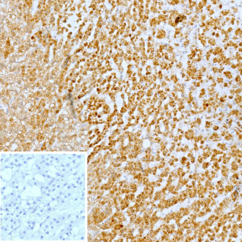 Anti-CXCR5 / Burkitt lymphoma receptor 1, clone CXCR5/13096
