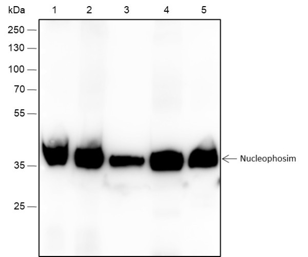 Anti-Recombinant NPM1, clone A315