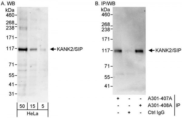 Anti-KANK2/SIP