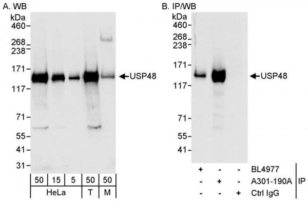 Anti-USP48