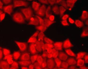 Anti-CA3 / Carbonic Anhydrase 3