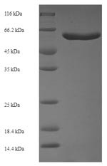 Cell division protein FtsZ (ftsZ), Escherichia coli O6:H1, recombinant