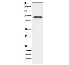 Anti-Topoisomerase I / TOP1, clone FIG-20