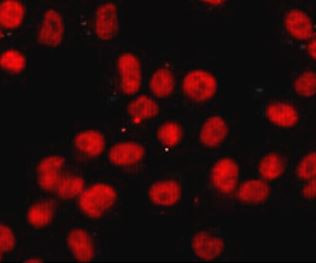 Anti-RBBP5, clone 1C9-1C9-H10