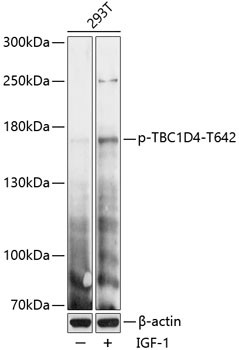 Anti-phospho-TBC1D4 (Thr642)