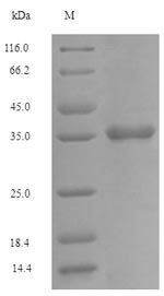 Fc receptor-like protein 6 (FCRL6), partial, human, recombinant