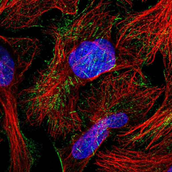 Anti-TCTN1