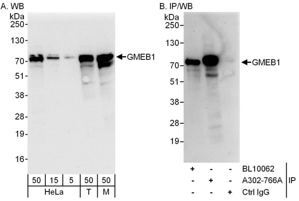 Anti-GMEB1