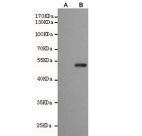 Anti-PPAR gamma / PPARG, clone 3G3-E2-H10
