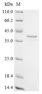 C-1-tetrahydrofolate synthase, cytoplasmic (MTHFD1),partial, human, recombinant