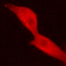 Anti-UCHL1 / PGP9.5, clone 7B8-G5-B8