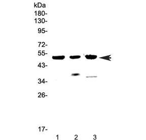 Anti-HTRA1