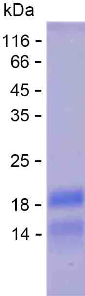Recombinant Human HGD Protein