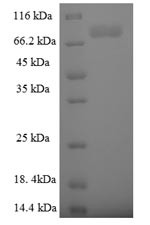 E3 ubiquitin-protein ligase TRIM9 (TRIM9), human, recombinant