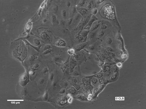 HROC277Met2 Cells