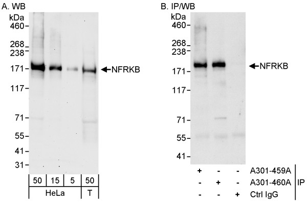 Anti-NFRKB