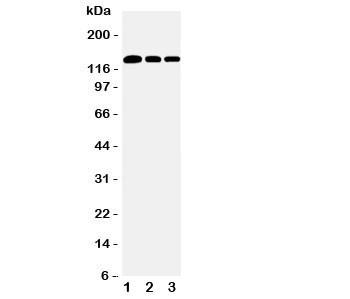 Anti-Collagen I / COL1A1