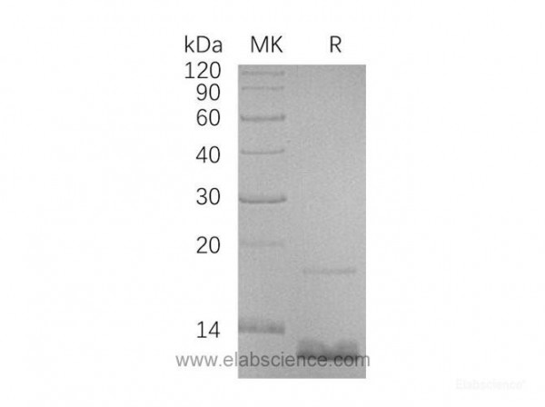 C-C Motif Chemokine 18/CCL18/PARC Protein(N-6His) (recombinant human)