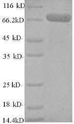 TNF receptor-associated factor 6 (TRAF6), human, recombinant