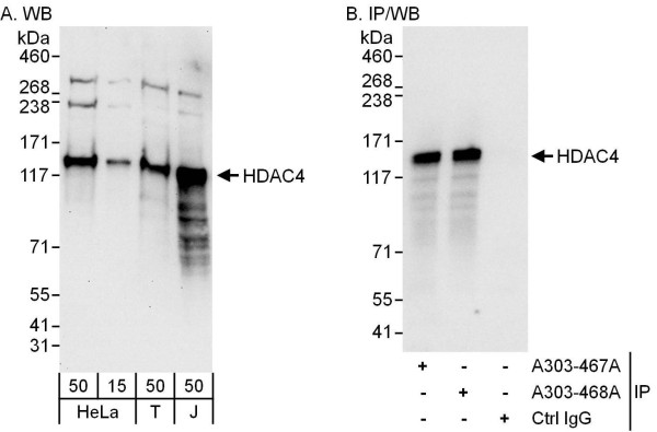 Anti-HDAC4