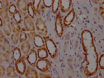 Anti-MYBBP1A Recombinant Monoclonal, clone 3A1
