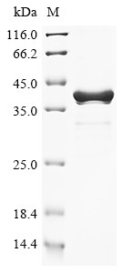 Phenylalanine-4-hydroxylase (phhA), Chromobacterium violaceum, recombinant