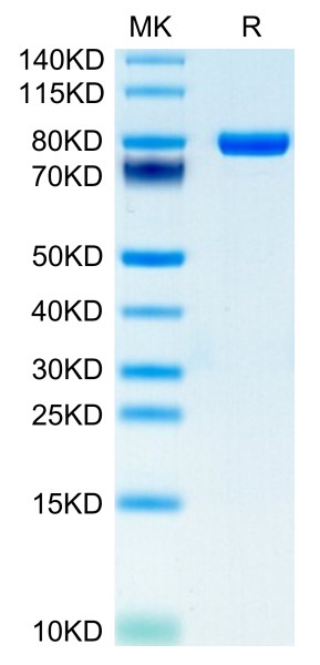 Human CD5 Protein