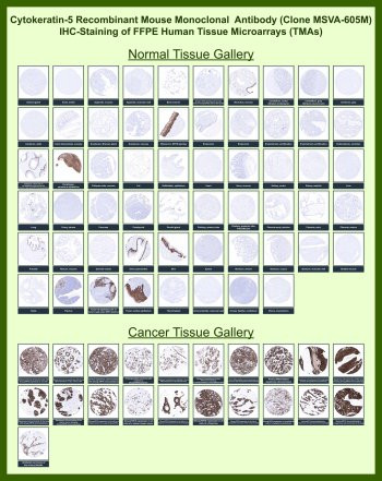 Anti-Cytokeratin 5 for IHC / KRT5, clone MSVA-605M