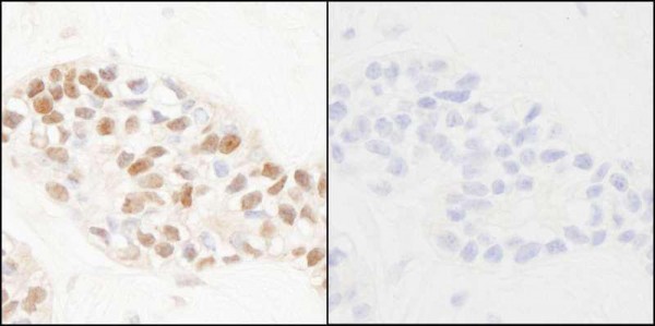 Anti-phospho-PCNA (Tyr211) (IHC)