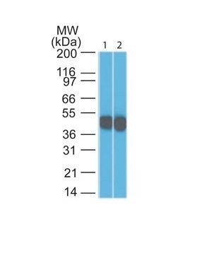 Anti-Cytokeratin 18(DC10), CF568 conjugate, 0.1mg/mL
