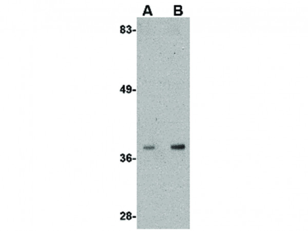 Anti-Aldh3A2