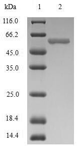 Immunoglobulin J chain (JCHAIN), human, recombinant