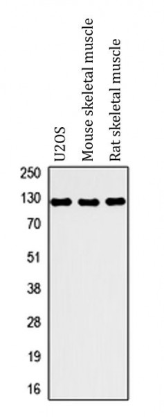 Anti-MYBPC1