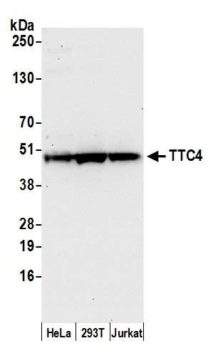 Anti-TTC4