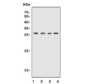 Anti-UPK1B / Uroplakin 1B