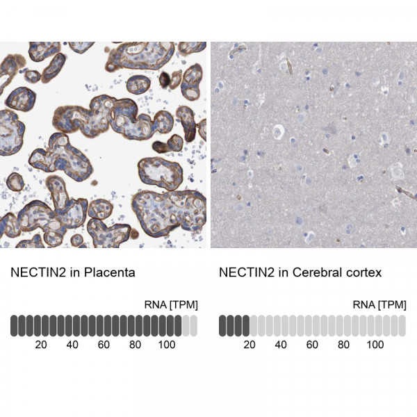 Anti-NECTIN2