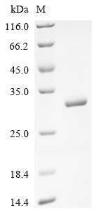 E3 ubiquitin-protein ligase RNF182 (RNF182), partial, human, recombinant