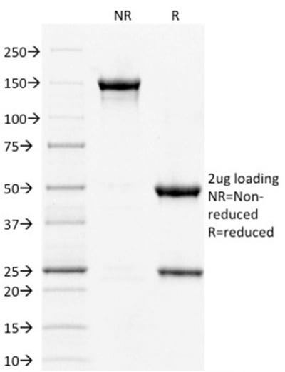 Anti-STAT3 / Signal Transducer and Activator of Transcription 3 (PCRP-STAT3-2F12), BSA-free, 1 mg/mL