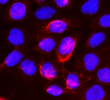 Anti-Beta Glucuronidase / Gusb