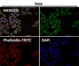 Anti-EIF3A / Eukaryotic translation initiation factor 3 subunit A, clone 31E29