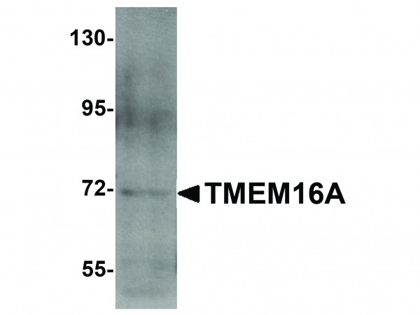 Anti-TMEM16A