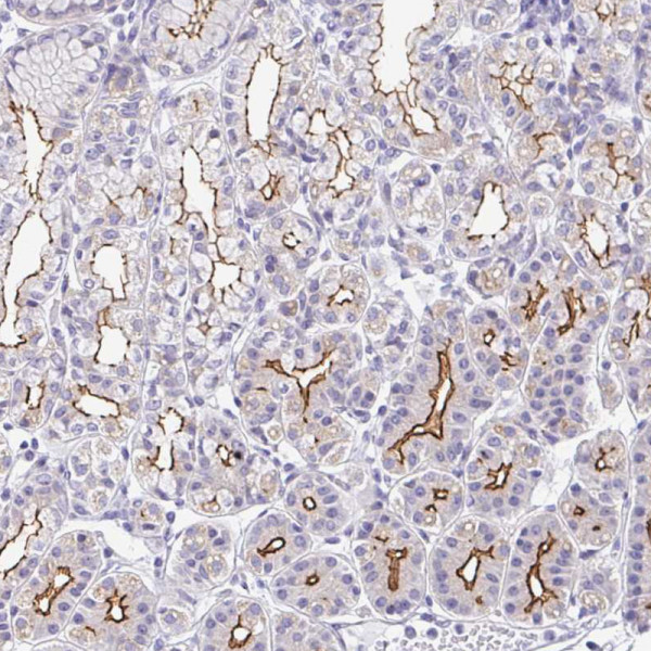 Anti-CGNL1