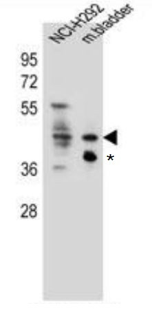 Anti-GHSR / Ghrelin Receptor